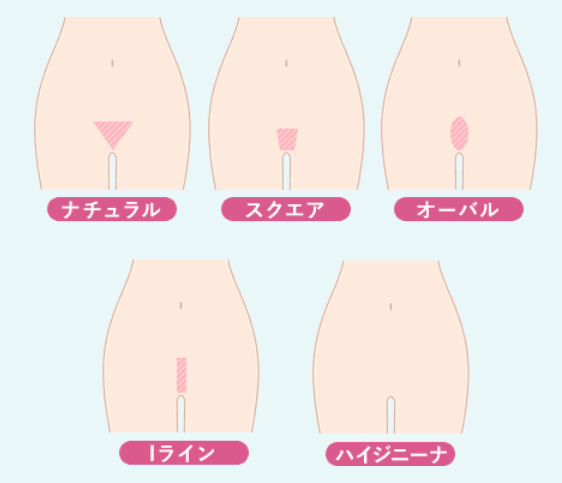 VIO脱毛のデザイン例の画像